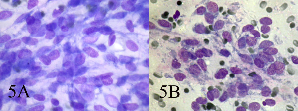 AB: Ovoid cells have short and long cytoplasmic processes; and finely granular chromatin and small or indistinct nuclei (Wright, Wright 400, 400).