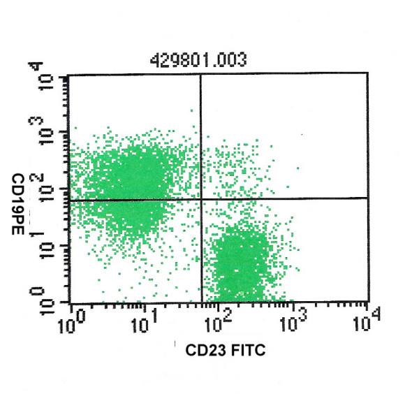 CD23 and CD19 positivity in that same case of small lymphocytic lymphoma