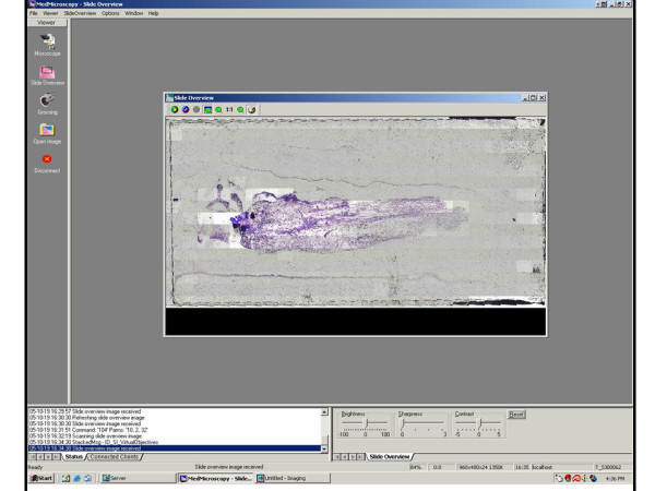 Client Side. Figure 1 shows the initial scan of a slide showing the whole slide. Time taken to perform overall scan averages 2 minutes when scanning with 4x objective. Individual squares are digital snapshots at a 24x16 grid, encompassing the entire slide