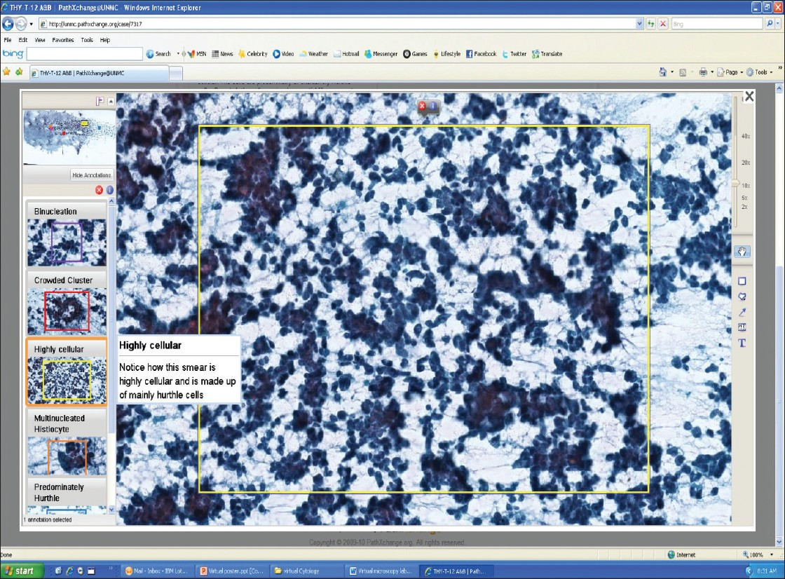 This image is an example of an annotated teaching slide seen on the UNMC PathXchange website