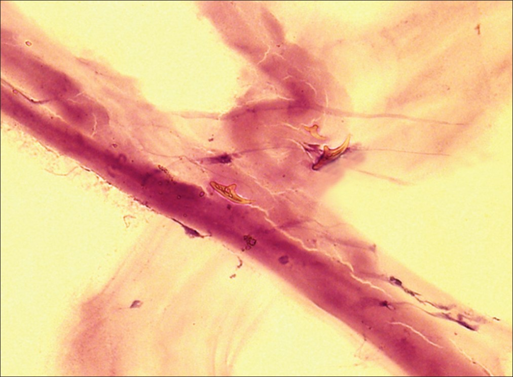 Amorphous acellular laminated membrane (cuticula) with a few hooklets (H and E stain, ×400)