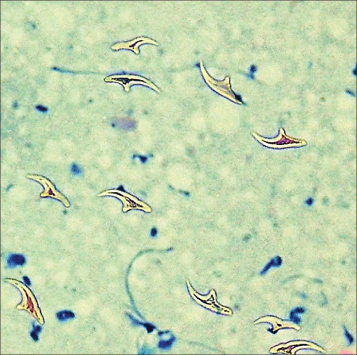 A large group of free hooklets (MGG, ×400)