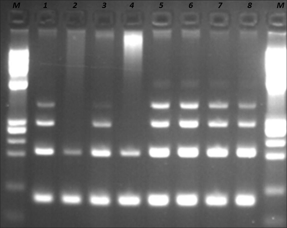 DNA quality control by Specimen Control Size ladder mix supplied with the kit. Samples at positions 1, 5, 6, 7, and 8 are controls supplied with the kit. Samples at positions 2, 3, and 4 are from patients. Sample 3 is the requested sample. Samples 2 and 4 have bad quality of DNA. M: PhiX174 / HaeIII digest ladder (New England Biolabs).