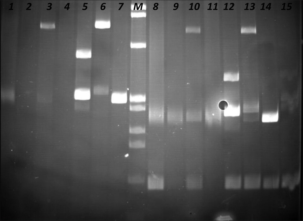 Identification of Clonal Immunoglobulin Heavy Chain Gene Rearrangements in non-denaturing polyacrylamide electrophoresis gels (PAGE). Positions 1 and 8 polyclonal controls, positions 2 –4, 9 – 11 samples, and positions 5 – 8, 12 – 16 clonal controls. Requested sample at positions 3 and 10.