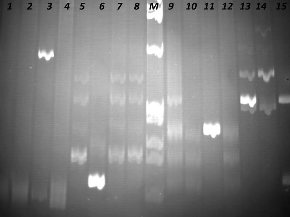 Identification of Clonal Immunoglobulin Heavy Chain Gene Rearrangements in non-denaturing polyacrylamide electrophoresis gels. Positions 1 and 9 polyclonal controls, positions 2 – 4, 10 – 12 samples, positions 5 – 8, 13 – 15 clonal controls. Requested sample at positions 3 and 11. M: PhiX174 / HaeIII digest ladder (New England Biolabs).