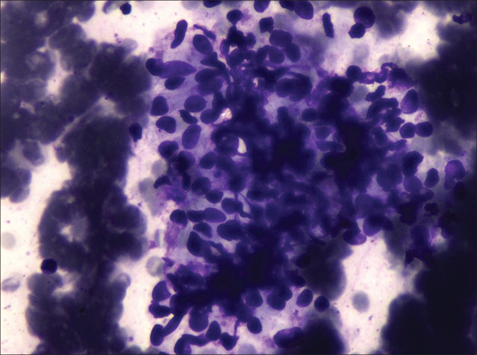 Cytology smears showing moderate cellularity, cells present in clusters (Giemsa, ×40)