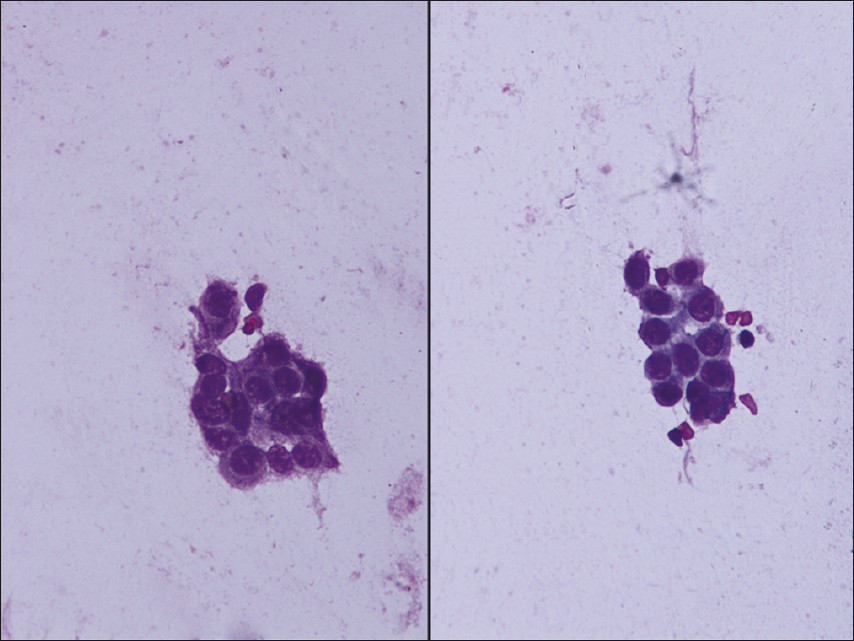 Photomicrograph showing loosely cohesive cluster of benign ductal cells with moderate cytoplasm (Papanicolaou, 40×)