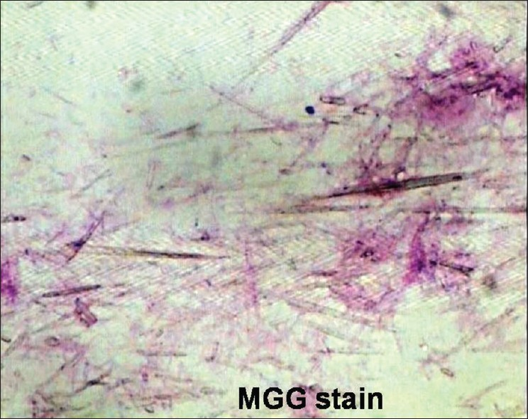 Elongated needle shaped crystals with pointed tips (MGG × 40)