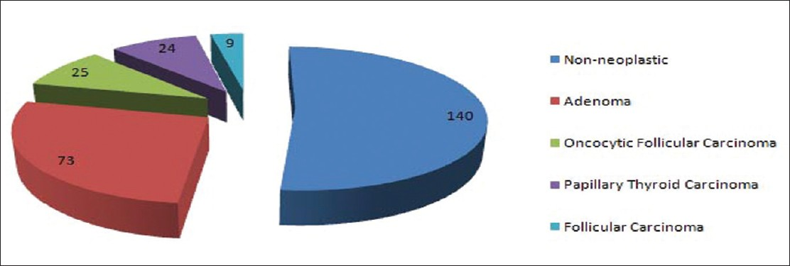 Surgical pathology follow-up of 296 diagnosed as oncocytic follicular neoplasm on fine-needle aspiration