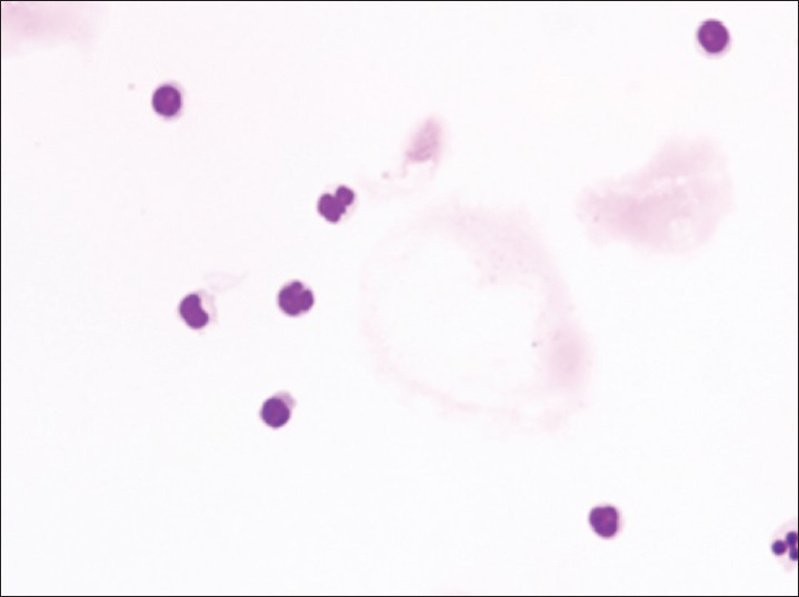 Mixed inflammation showing small numbers of lymphocytes and neutrophils