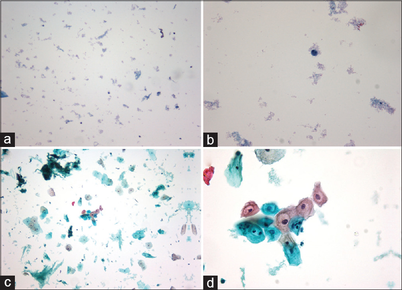 (a) ThinPrep × 10 before conversion, (b) ThinPrep × 40 before conversion, (c) SurePath × 10 after conversion, (d) SurePath × 40 after conversion