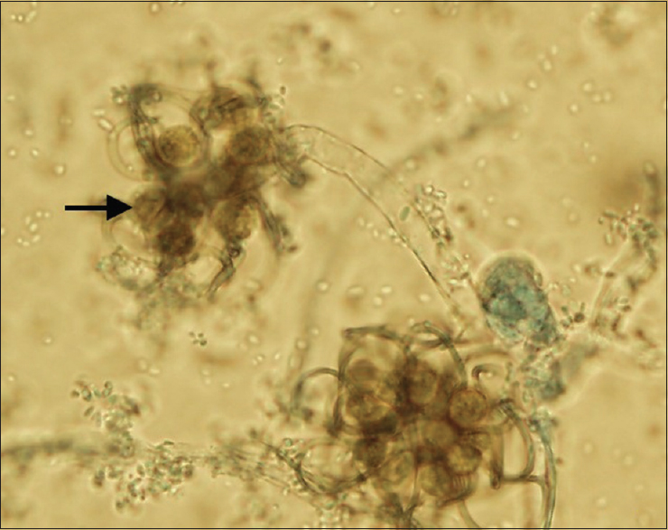 Sporangiola (arrow) produced at the tips of recurved or twisted stalks on a vesicle of a sporangiophore (×100)