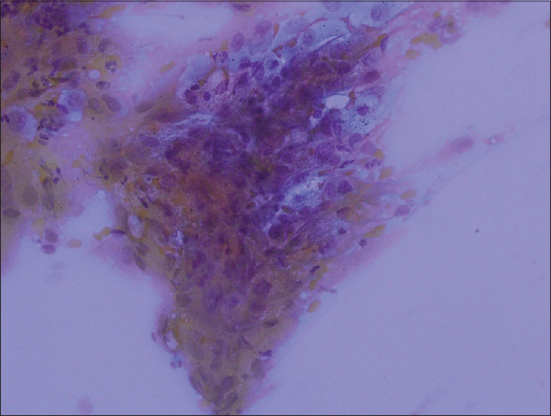 An example of suboptimal slides. The details of the cell group cannot be distinguished (Giemsa, ×20)