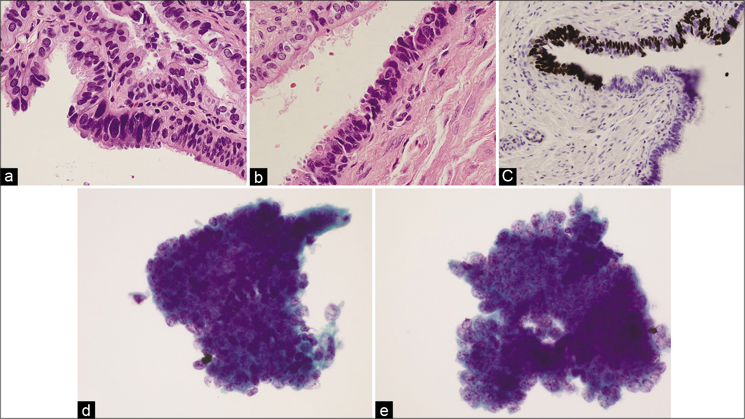 Cytological Spectrum Of Salivary Gland Lesions And Their SexiezPix Web Porn