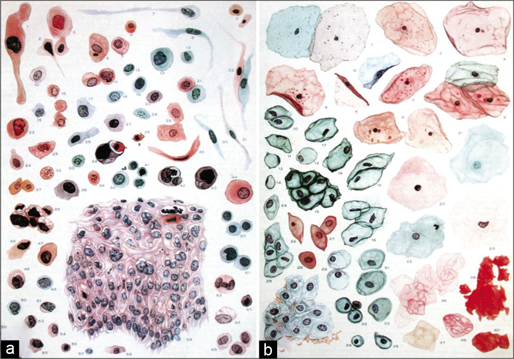 (a and b) Sketches of normal and abnormal cervicovaginal cells.