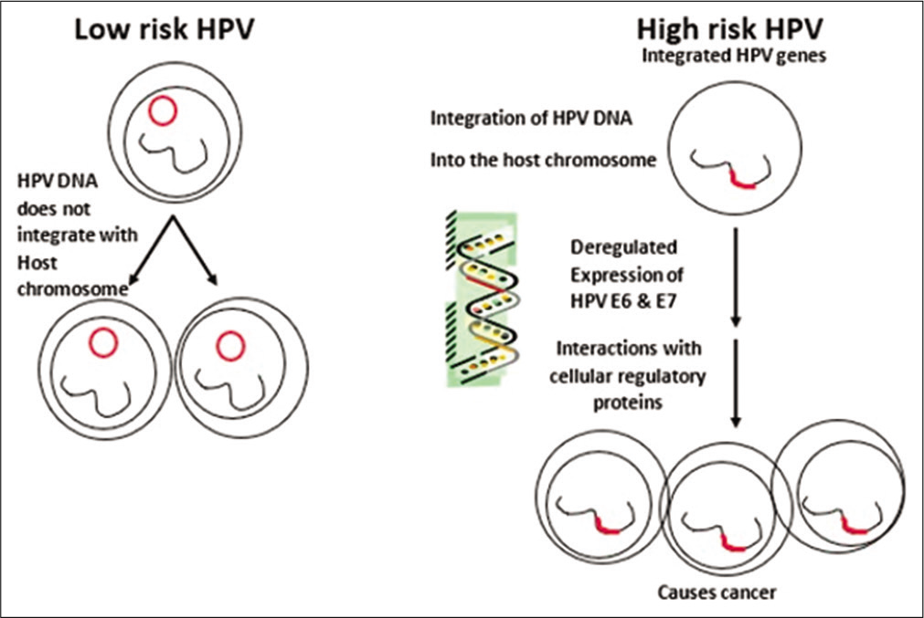 Pathogenesis of low-risk and high-risk HPV.[11]