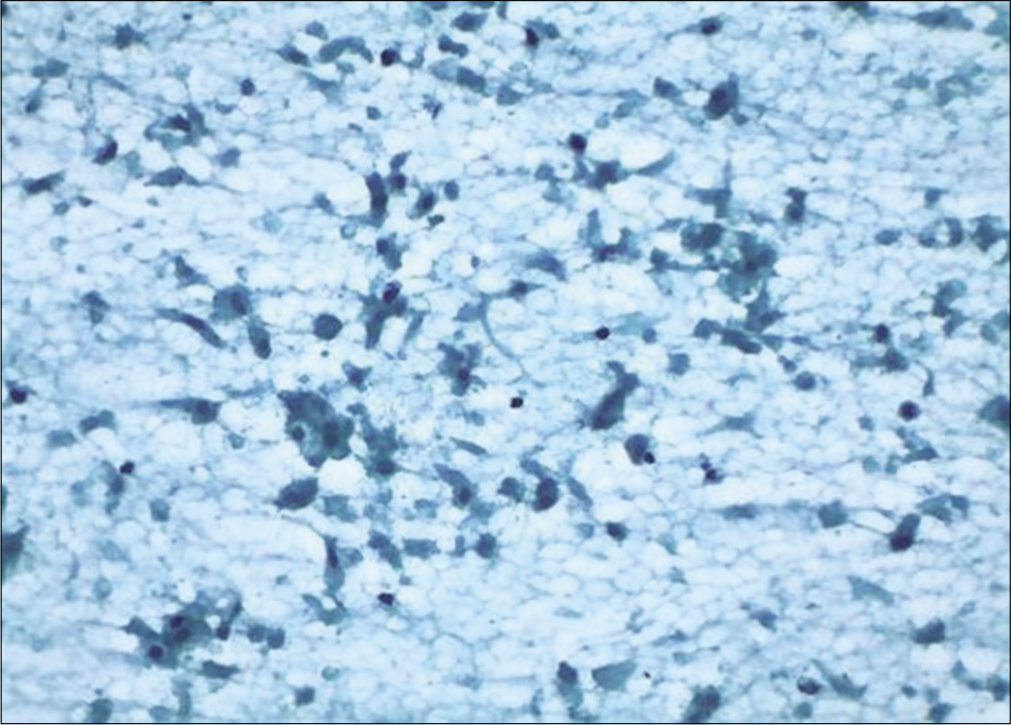 Conventional smear: Granular background and disintegrating squamous and glandular cells showing features of ischemia after cautery (×10).