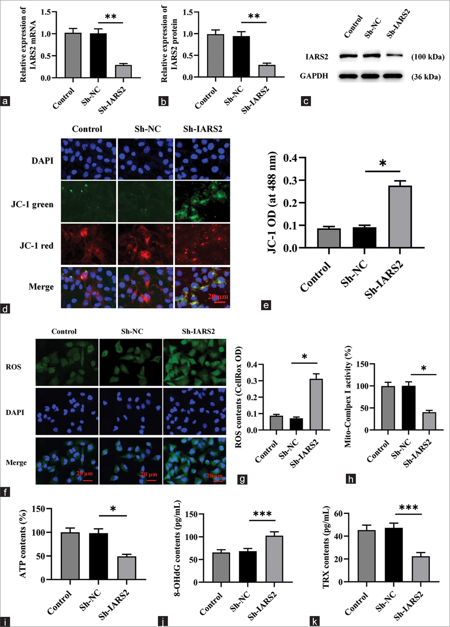 The knockdown of Isoleucyl-tRNA synthetase 2 (IARS2) impairs mitochondrial function in cervical cancer cells. (a-c) Assessment of the transfection efficiency of Sh-IARS2 in control, Sh-negative control (NC), Sh-IARS2 groups through quantitative reverse transcription polymerase chain reaction and Western blot. (d and e) Measurement of JC-1 fluorescence intensity and activity in control, Sh-NC (negative control), Sh-IARS2 groups. Magnification is 200x. (f and g) Quantitative analysis of reactive oxygen species levels and fluorescence intensity in Control, Sh-NC, Sh-IARS2 groups. Magnification is 200x. (h) Determination of mitochondrial complex I activity in control, Sh-NC, Sh-IARS2 groups. (i) Quantification of adenosine triphosphate levels in control, Sh-NC, Sh-IARS2 groups. (j and k) Measure the levels of 8-OHdG and TPX in the control group, Sh-NC group, and Sh-IARS2 group. (n = 6). (*P < 0.05, **P < 0.01, ***P < 0.001).