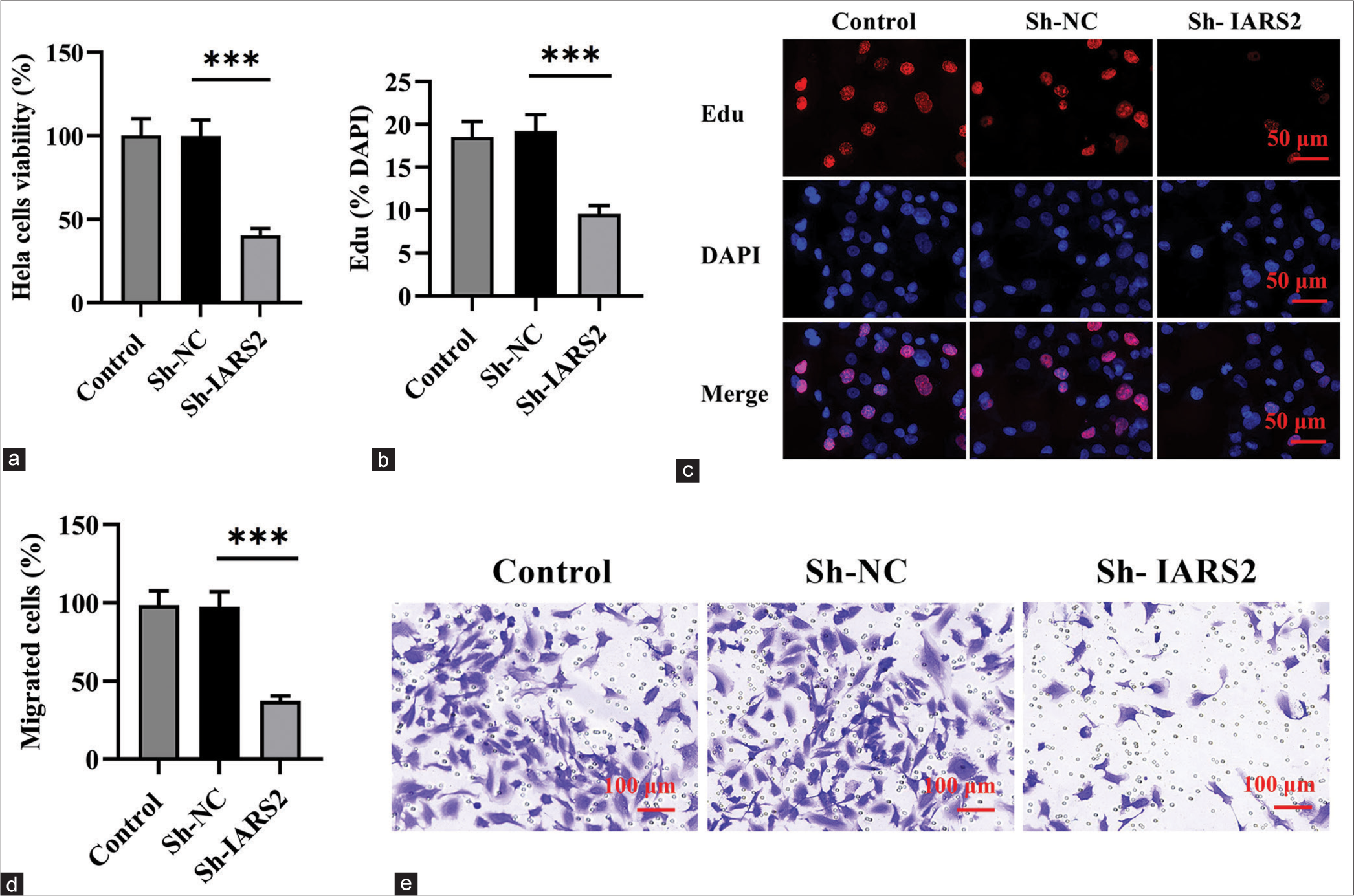 The knockdown of Isoleucyl-tRNA synthetase 2 (IARS2) hinders the vitality, proliferation, and migration of cervical cancer cells. (a) Cell counting kit-8 assay measuring the activity of Hela cells. (b and c) Cell proliferation assessed by the 5-ethynyl-2’-deoxyuridine (EdU) incorporation method (nuclear EdU staining). (d and e) Transwell experiment evaluating cell migration. (n = 6). (***P < 0.001).