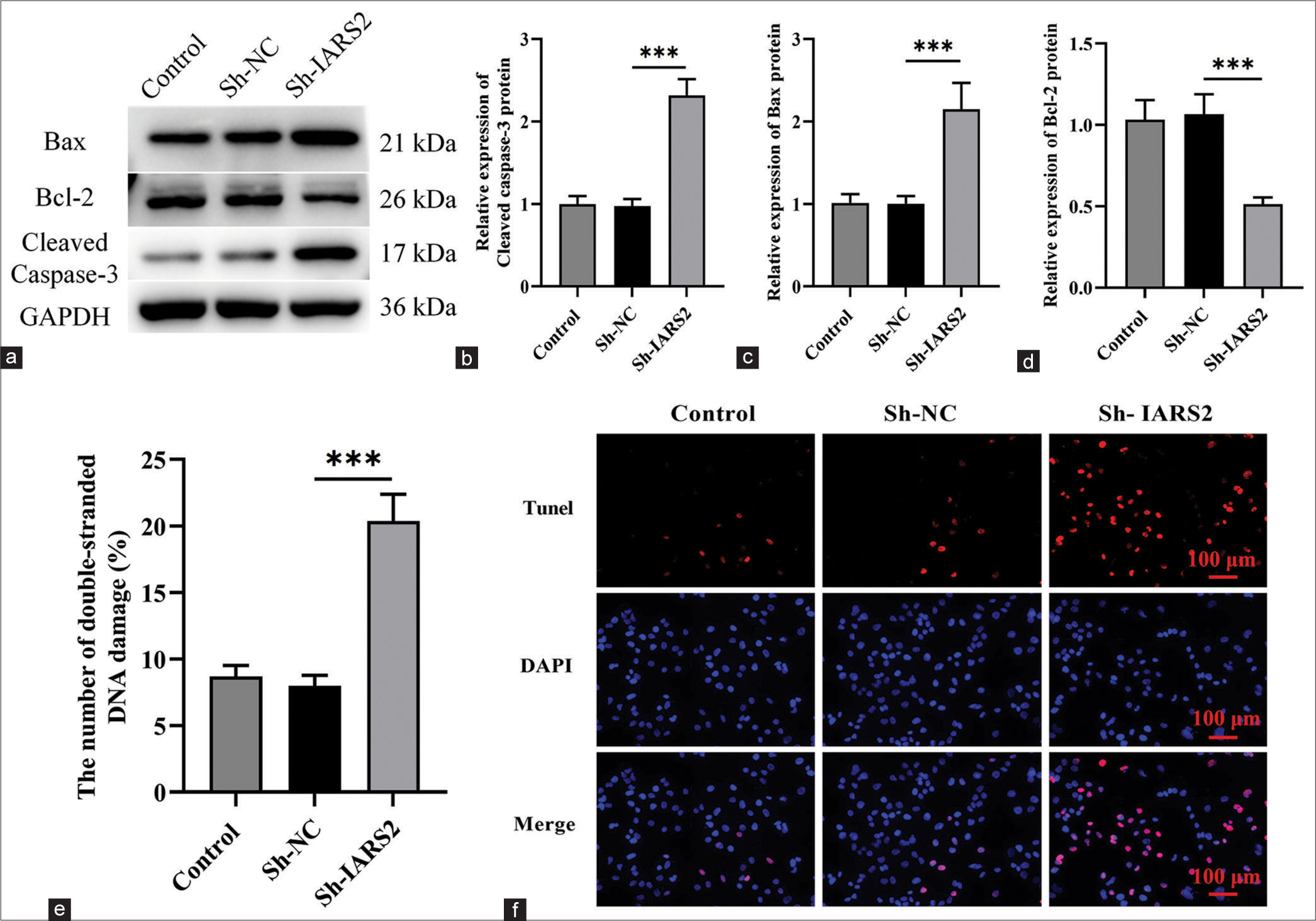 The depletion of isoleucyl-tRNA synthetase 2 prompts apoptosis in cervical cancer cells. (a-d) Evaluation of the protein expression levels of cleaved caspase-3, Bax, and Bcl-2 in Control, Sh-NC, Sh-IARS2 groups. (e and f) Detection of cell apoptosis through nuclear terminal deoxynucleotidyl transferase dUTP nick end labeling staining in Control, Sh-NC, Sh-IARS2 groups (n = 6). NC: negative control, IARS2: Isoleucyl-tRNA synthetase 2. (***P < 0.001).