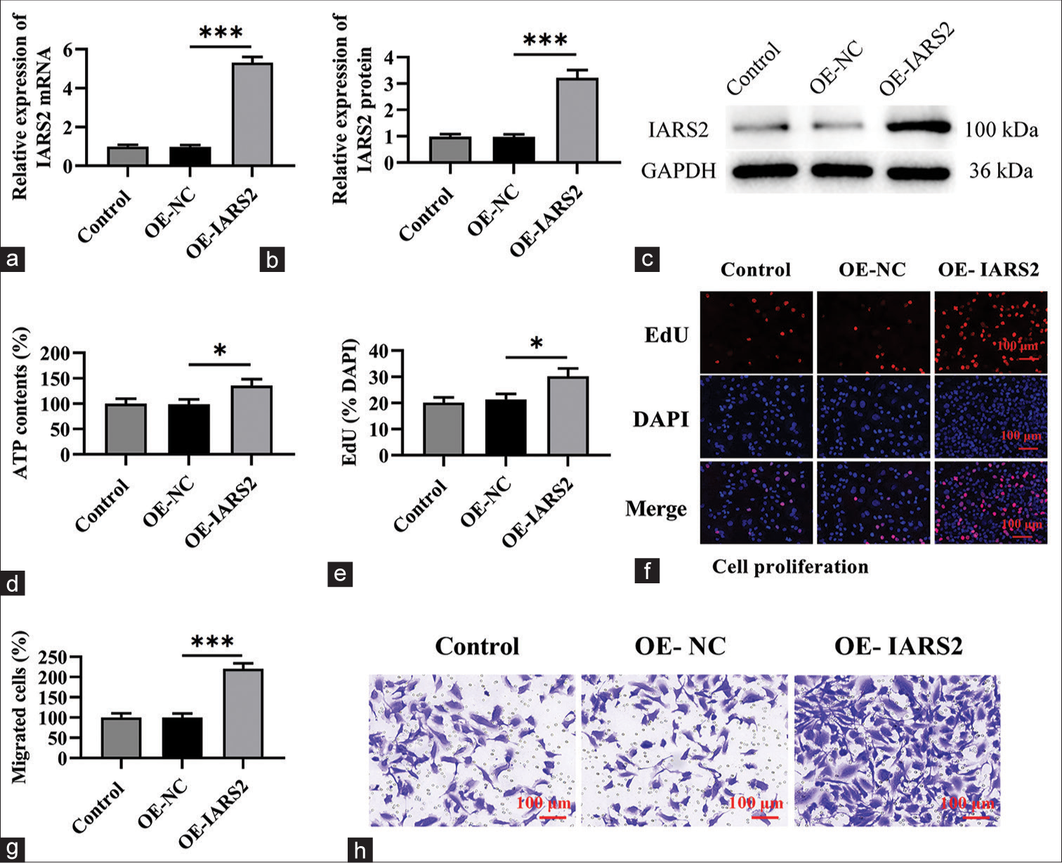 Overexpression of Isoleucyl-tRNA Synthetase 2 (IARS2) enhances the progression of cervical cancer cells. (a-c) Measurement of messenger Ribonucleic Acid and protein levels of IARS2 in Control, OE-NC, OE-IARS2 groups. (d) Determination of adenosine triphosphate levels in cells in Control, OE-NC, OE-IARS2 groups. (e and f) Cell proliferation assay (nuclear EdU incorporation). (g and h) Transwell assay assessing cell migration capability. (*P < 0.05, ***P < 0.001).