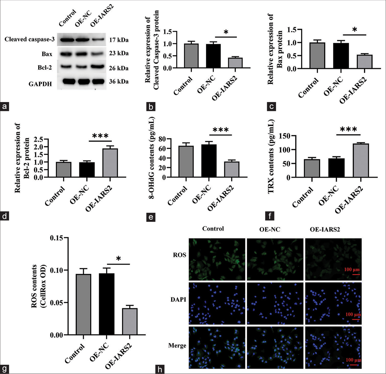 Overexpression of Isoleucyl-tRNA Synthetase 2 (IARS2) induces pro-carcinogenic activity in cervical cancer cells. (a-d) The protein expression levels of Cleaved caspase-3, Bcl-2, and Bax in Control, OE-NC, OE-IARS2 groups were determined by western blot. (e and f) Levels of 8-Hydroxy-2'-deoxyguanosine and Thioredoxin. (g and h) Reactive oxygen species fluorescence staining and quantitative analysis. (n = 6). NC: negative control, IARS2: Isoleucyl-tRNA synthetase 2. (*P < 0.05, ***P < 0.001).