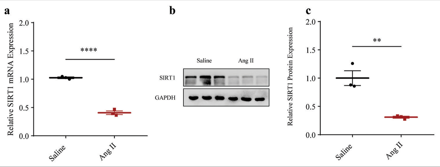 Lower SIRT1 expression in Ang II-induced HASMCs. (a) Quantified SIRT1 expression in Ang II-induced modeled or saline-treated control HASMCs via qRT-PCR. (b and c) Relative SIRT1 protein expression in Ang II-induced modeled or saline-treated HASMCs based on immunoblotting. All experimental data were derived from over three independent tests and expressed as mean ± standard deviation. (**P < 0.01, ****P < 0.0001. SIRT1: Sirtuin 1, Ang II: Angiotensin II, HASMCs: Human aortic smooth muscle cells, qRT-PCR: Quantitative real-time polymerase chain reaction, SIRT1: Sirtuin 1.)