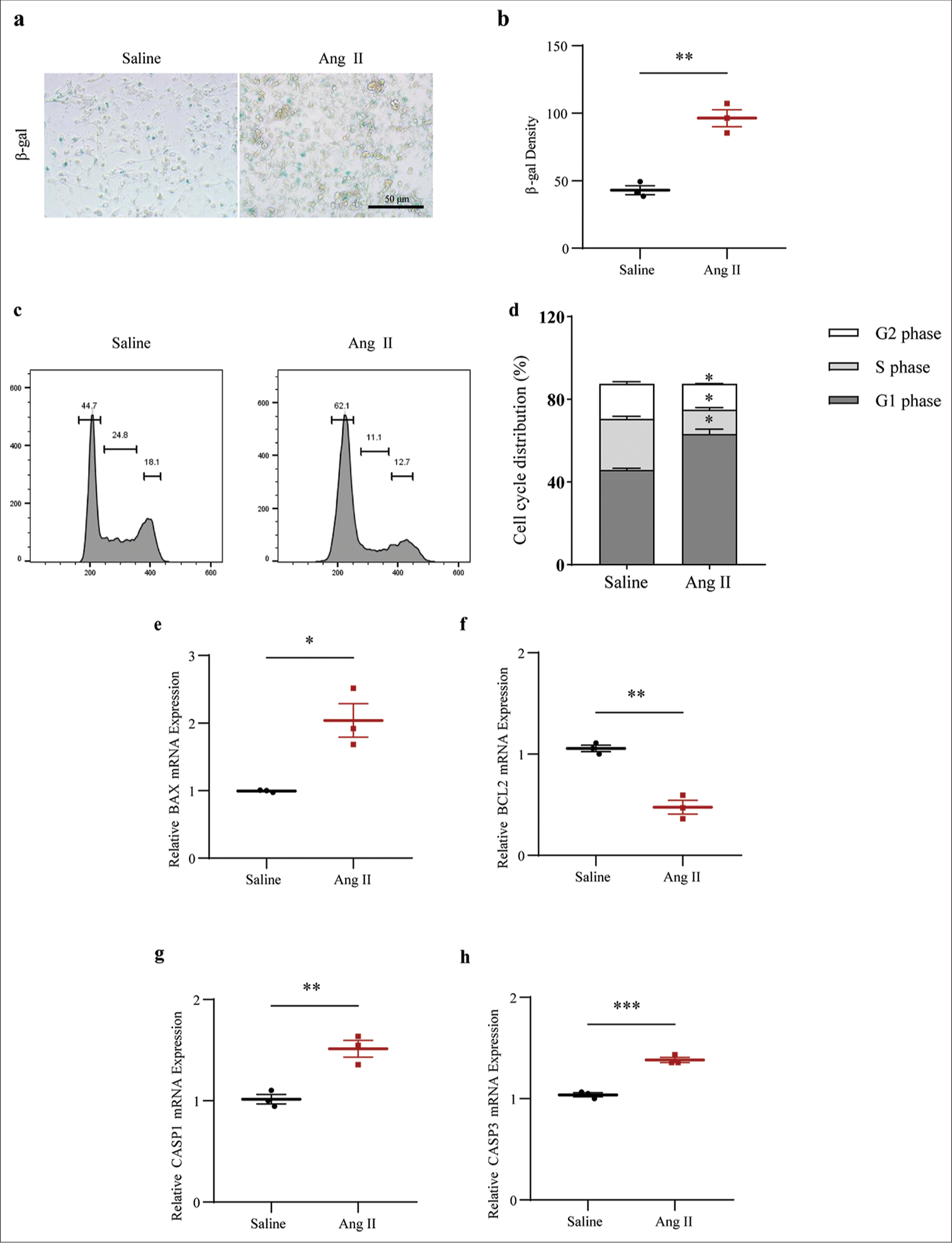 Determination of the senescence-associated secretory phototype, cell cycle, and cell apoptosis in Ang II-induced HASMCs. (a and b) Visualized senescent HASMCs in different groups and the quantified b-gal density based on SA b-gal staining test (scale bar: 50 μm). (c and d) Relevant results regarding cell cycles in the HASMCs of different groups based on flow cytometry. (e-h) Based on qRT-PCR, the differences in mRNA expression levels of apoptosis-related proteins BAX (e), BCL2 (f), CASP1 (g), and CASP3 (h) in HASMCs of Ang II and Saline groups were assessed. All experimental data were derived from over three independent tests and expressed as mean ± standard deviation. (*P < 0.05, **P < 0.01, ***P < 0.001. SIRT1: Sirtuin 1, Ang II: Angiotensin II, HASMCs: Human aortic smooth muscle cells, SA b-gal: Senescence-associated b-gal, BAX: BCL2 associated X, BCL2: BCL2 apoptosis regulator, CASP1: Caspase 1, CASP3: Caspase 3, mRNA: Messenger RNA, qRT-PCR: Quantitative real-time polymerase chain reaction.)