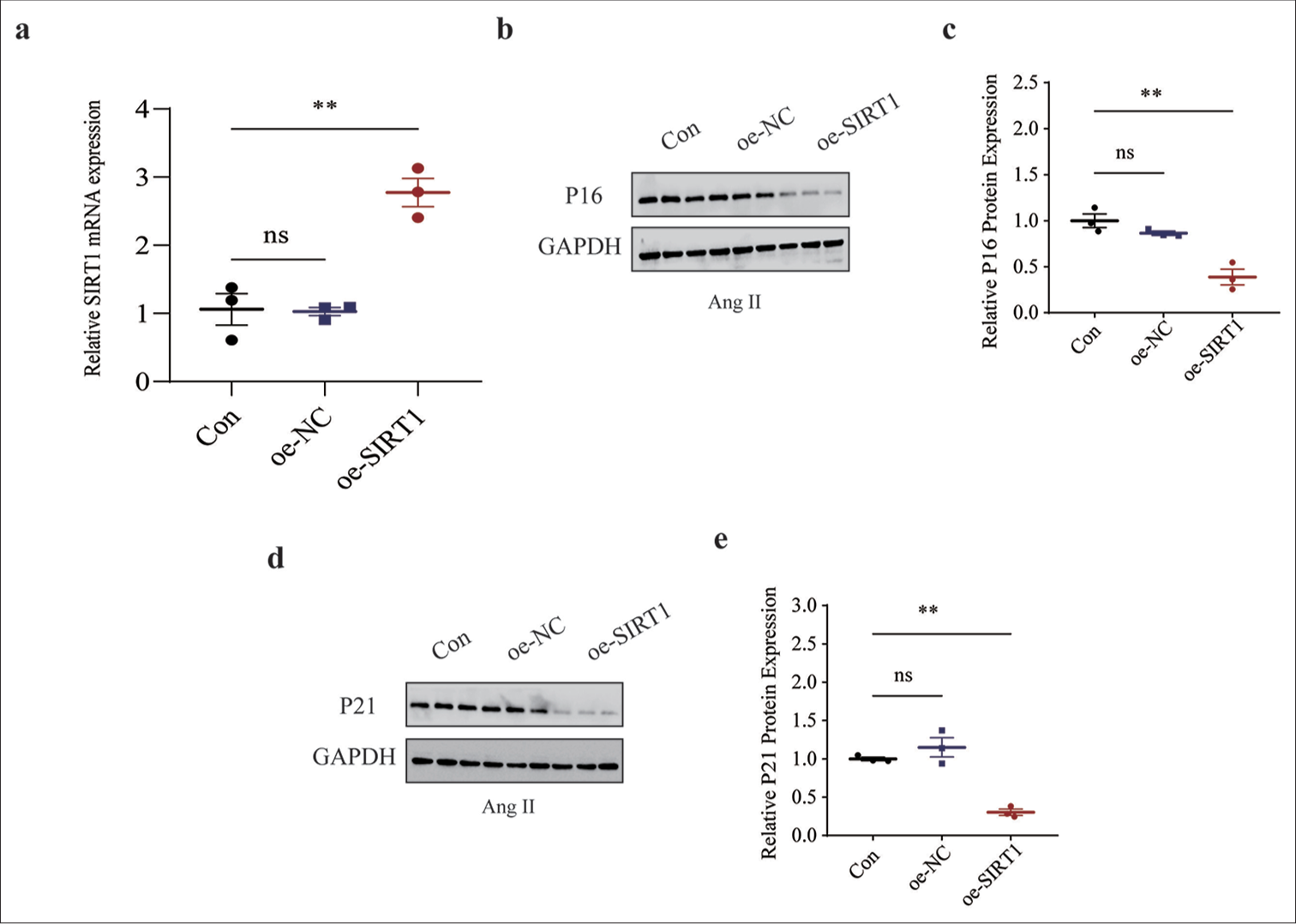 Effects of overexpressed SIRT1 on senescence-related protein expressions in Ang II-induced HASMCs. (a) qRT-PCR was used to validate the transfection efficiency of lentivirus overexpressing SIRT1. (b and c) Relative P16 protein expression in Ang II-induced HASMCs following SIRT1 overexpression based on immunoblotting. (d and e) Relative P21 protein expression in Ang II-induced HASMCs following SIRT1 overexpression based on immunoblotting. All experimental data were derived from over three independent tests and expressed as mean ± standard deviation. (ns: P > 0.05, **P < 0.01. SIRT1: Sirtuin 1, Ang II: Angiotensin II, HASMCs: Human aortic smooth muscle cells, Con: Control, oe-NC: Negative control of overexpression plasmid, oe-SIRT1: SIRT1 overexpression plasmid, qRT-PCR: Quantitative real-time polymerase chain reaction, ns: no significance, GAPDH: Glyceraldehyde-3-phosphate dehydrogenase.)