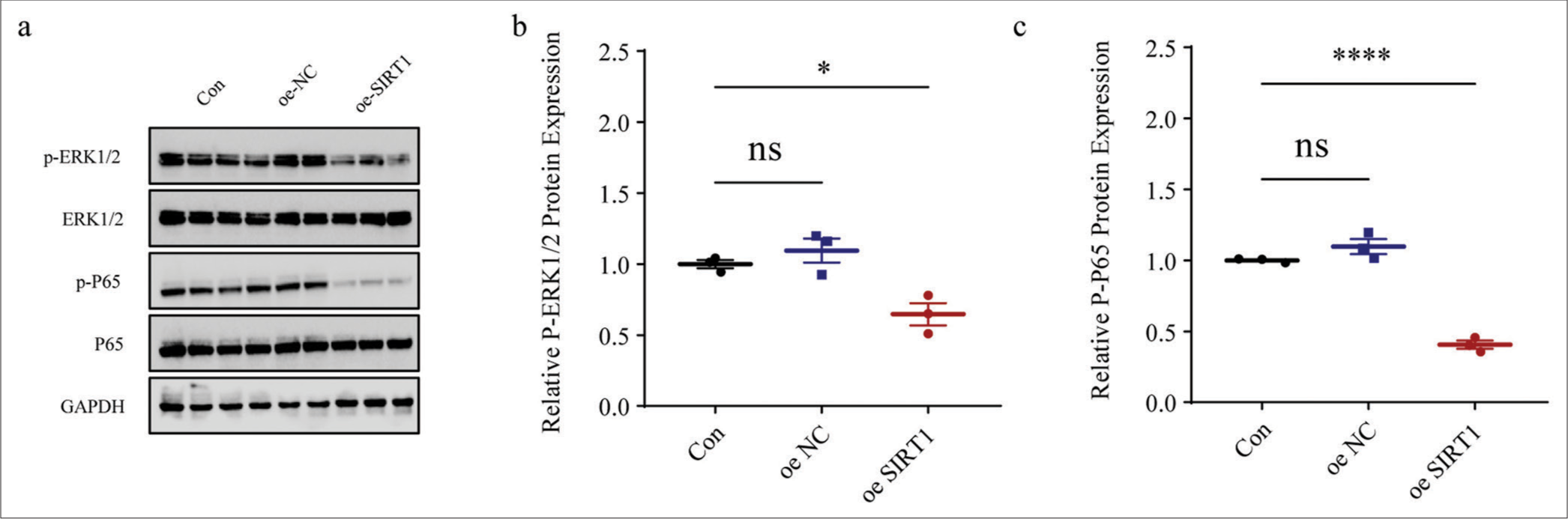 Effects of SIRT1 overexpression on NF-kB- and MAPK-related proteins levels in Ang II-induced HASMCs. (a-c) Quantified phosphorylation levels of ERK1/2 and P65 in Ang II-induced HASMCs following SIRT1 overexpression based on immunoblotting. All experimental data were derived from over three independent tests and expressed as mean ± standard deviation. (ns: P > 0.05, *P < 0.05, ****P < 0.0001. SIRT1: Sirtuin 1, Ang II: Angiotensin II, HASMCs: Human aortic smooth muscle cells, Con: control, oe-NC: Negative control of overexpression plasmid, oe-SIRT1: SIRT1 overexpression plasmid, p-ERK1/2: Phosphorylated-ERK1/2, ERK1/2: Extracellular signal-regulated kinase 1/2, p-P65: Phosphorylated-P65, NF-kB: Nuclear factor-kappa B, MAPK: Mitogen-activated protein kinases, ns: no significance, GAPDH: Glyceraldehyde-3-phosphate dehydrogenase.)