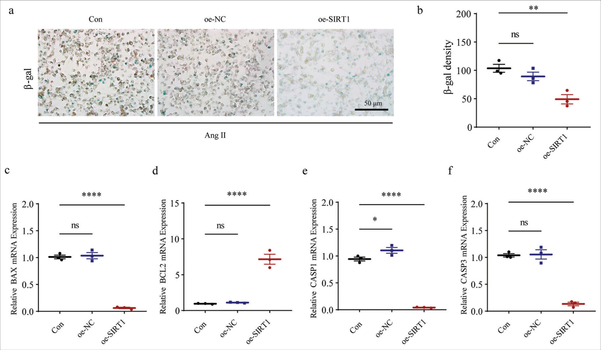 Effects of SIRT1 overexpression on Ang II-induced senescence and apoptosis in HASMCs. (a and b) SA b-gal staining tests were performed to visualize the results of staining and b-gal density quantification of HASMCs after SIRT1 overexpression. (c-f) Effects of SIRT1 overexpression on the expression levels of apoptosis-related gene BAX (c), BCL2 (d), CASP1 (e), and CASP3 (f) mRNA in HASMCs. (ns: P > 0.05, *P < 0.05, **P < 0.01, ****P < 0.0001. SIRT1: Sirtuin 1, Ang II: Angiotensin II, HASMCs: Human aortic smooth muscle cells, Con: Control, oe-NC: Negative control of overexpression plasmid, oe-SIRT1: SIRT1 overexpression plasmid, SA b-gal: Senescence-associated b-gal, BAX: BCL2 associated X, BCL2: BCL2 apoptosis regulator, CASP1: Caspase 1, CASP3: Caspase 3, mRNA: Messenger RNA, ns: no significance, GAPDH: Glyceraldehyde-3-phosphate dehydrogenase.)