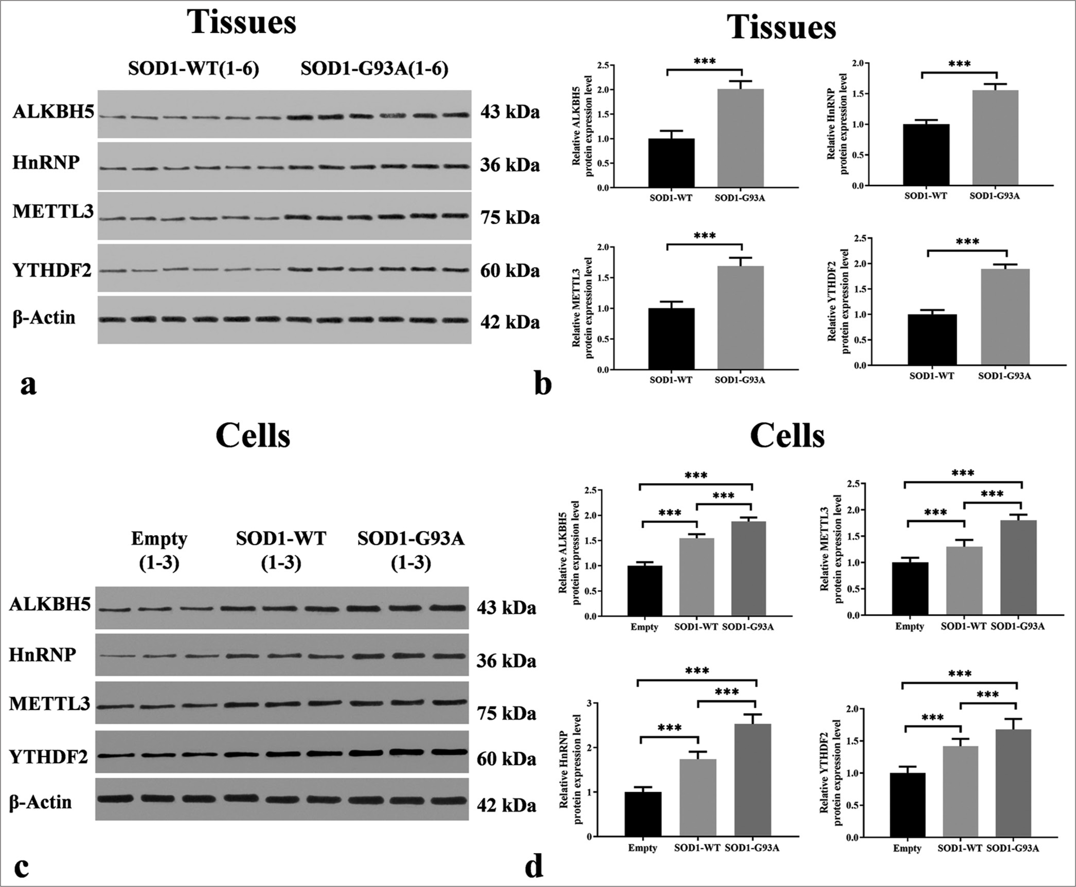 Differential expressions of m6A methyltransferases in the spinal cord tissues of SOD1-G93A mouse model and amyotrophic lateral sclerosis cell model. (a) Tissue samples, with groupings shown at the top and proteins on the left. Protein band images can be found in the middle. (b) Protein expression levels in tissue samples, with the vertical axis representing relative protein expression levels and the horizontal axis indicating groupings. (c) Cell samples, with groupings displayed at the top and proteins on the left. Protein band images can be found in the middle. (d) Protein expression levels in cell samples, with the vertical axis representing relative protein expression levels and the horizontal axis denoting groupings (***P < 0.001). METTL3: Methyltransferase-like 3, YTHDF2: YTH N6-methyladenosine RNA binding protein 2, ALKBH5: AlkB homolog 5. HnRNP/SOD1/SOD1-WT: Heterogeneous Nuclear Ribonucleoprotein/Superoxide Dismutase 1/ Superoxide Dismutase 1-wild-type