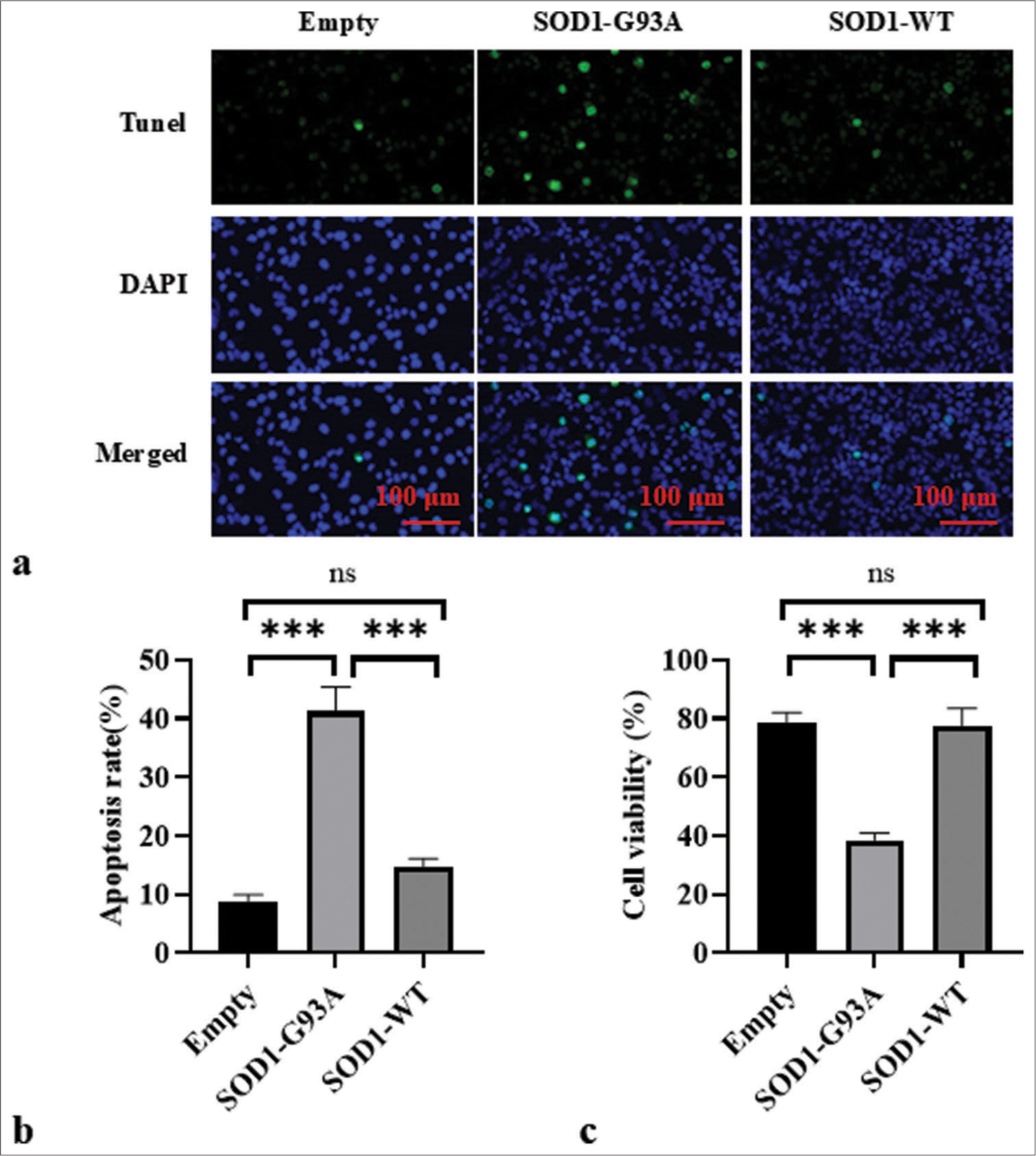 Apoptosis in each group was assessed through TUNEL staining. (a) Cell apoptosis in each group was observed by TUNEL staining. DAPI staining revealed the uniform blue fluorescence of the nuclei of all groups. TUNEL staining showed a green fluorescent signal, which indicates the DNA breakage often associated with apoptosis. The composite image shows an overlay of blue and green fluorescence. (b) Empty, SOD1-G93A, and SOD1-WT group apoptosis ratio. (c) Cell viability in Empty, SOD1-G93A, and SOD1-WT groups. (ns: no significant difference, ***P<0.001). (TUNEL: Terminal deoxynucleotidyl transferase dUTP nick end labeling; DAPI: 4',6-diamidino-2-phenylindole, SOD1-G93A/SOD1_WT: Superoxide Dismutase 1 - G93A mutant/Superoxide Dismutase 1-wild-type.)