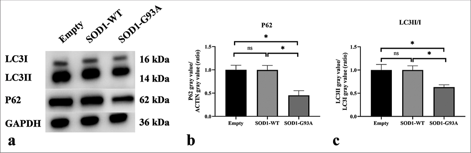 Western blot was used to detect the expression levels of P62 and LC3II/I. (a) Western blot analysis of LC3II, LC3I, and P62 proteins. (b) Quantitative analysis of P62. (c) Quantitative analysis of LC3II/I (ns: no significant difference, *P < 0.05). P62: Sequestosome 1, LC3: Microtubule-associated protein 1 light chain 3, LC3-I: The cytosolic form of LC3, LC3-II: The membrane-bound form that is associated with autophagosomes. (GAPDH: Glyceraldehyde-3-phosphate dehydrogenase.)