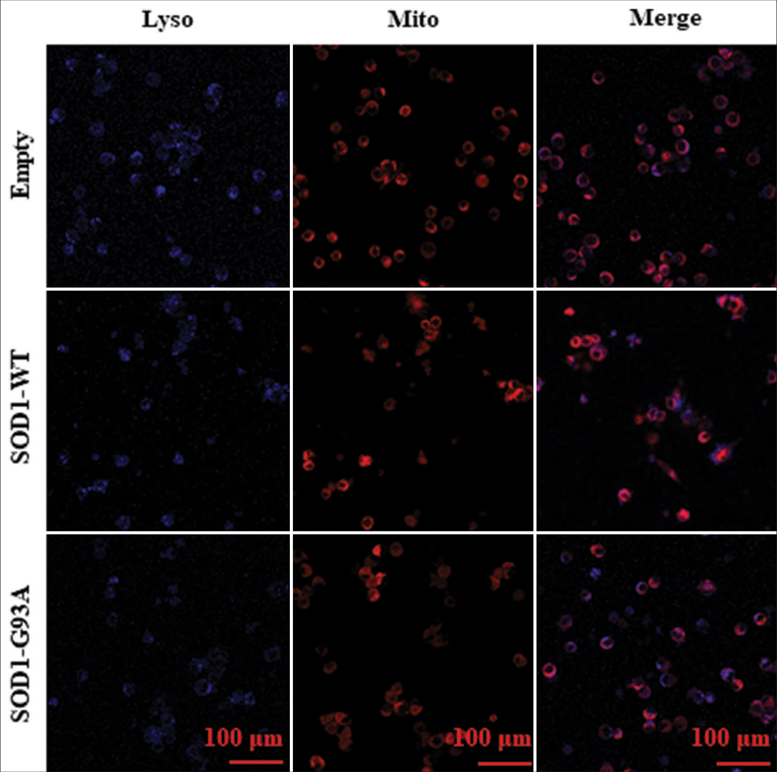 Mito- and Lyso-tracer probes were used in immunofluorescence staining to observe the morphology and size of mitochondria and the number of lysosomes in various cell models and analyze their colocalization. Each row in Figure 6 represents various cell types: empty control group (Empty), WT SOD1 (SOD1 WT), and mutant SOD1 (SOD1-G93A). Lyso probe stained lysosomes are shown in blue and Mito probe-stained mitochondria in red. Colocalization can be observed in the merged images.