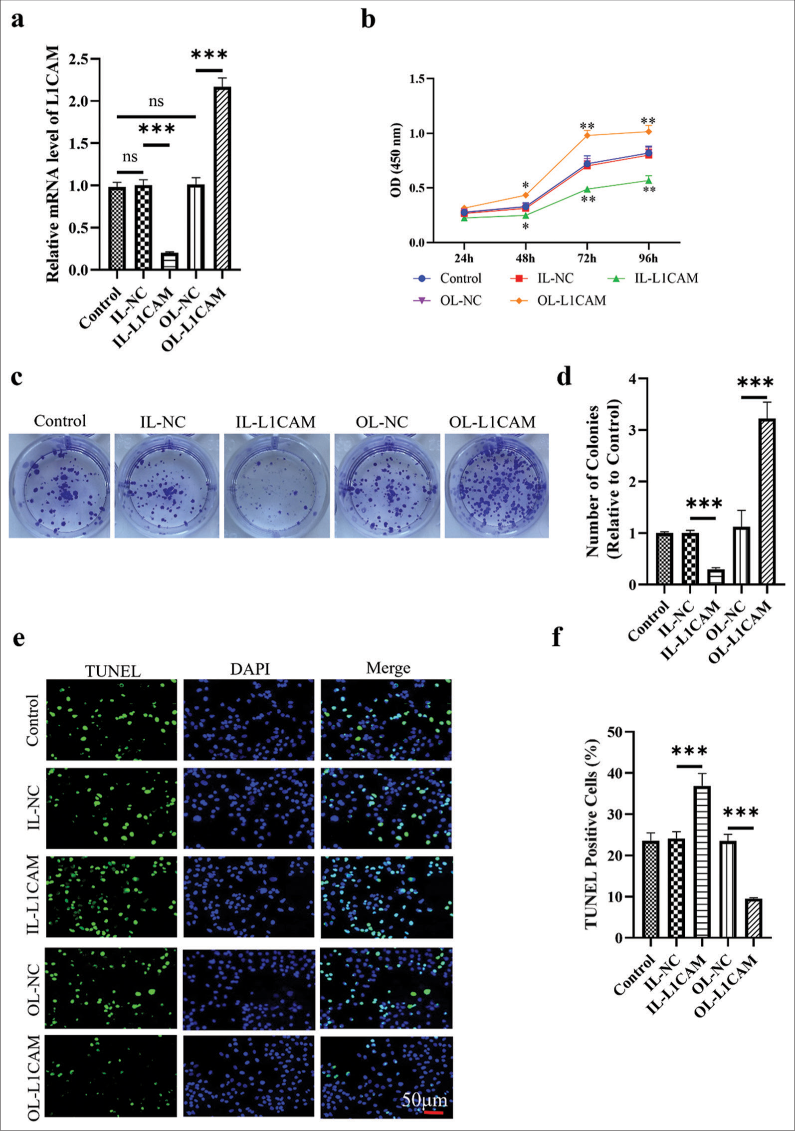 L1CAM promotes the proliferation and survival of EC cells. (a) L1CAM mRNA expression levels in transfected KLE cells obtained by RT-qPCR (n = 5). Results of (b) CCK-8 assay (n = 5), (c and d) colony forming assay (n = 5), and (e and f) TUNEL assay (n = 5) for transfected KLE cells. *P < 0.05 indicates statistical significance. **P < 0.01 indicates high statistical significance. *** P < 0.001 indicates very high statistical significance. (ns stands for no significance, L1CAM: L1 cell adhesion molecule, EC: Endometrial cancer, RT-qPCR: Reverse transcription quantitative real-time polymerase chain reaction, mRNA: Messenger RNA, CCK: Cell counting kit, TUNEL: Terminal deoxynucleotidyl transferase-mediated dUTP nick-end labeling, OD: Optical density, IL: Interference lentivirus, NC: Negative control, DAPI,4’,6-Diamidino-2’-phenylindole.)