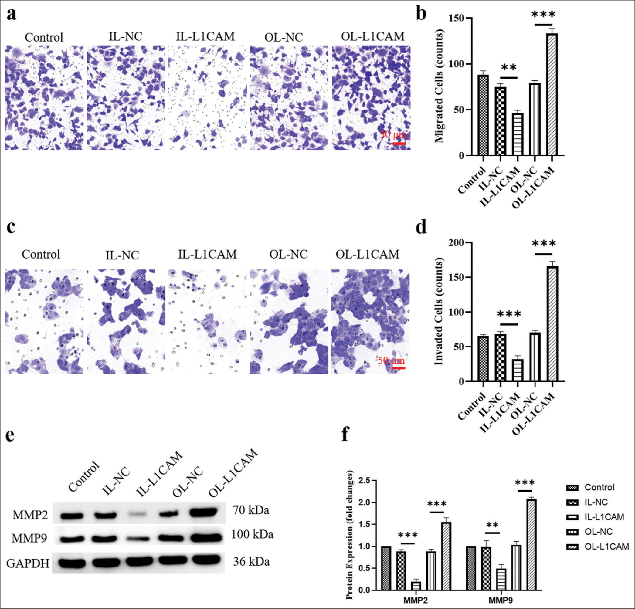 L1CAM promotes the metastasis of EC cells. (a and b) Transwell assay for migration (n = 5) and (c and d) Transwell assay for invasion (n = 5) for transfected KLE cells. (e and f) Protein levels of MMP2 and MMP9 obtained by Western blot (n = 5). (**P < 0.01 indicates high statistical significance.***P < 0.001 indicates very high statistical significance. L1CAM: L1 cell adhesion molecule, EC: Endometrial cancer, MMP: Matrix metalloproteinase, OL: Overexpression lentivirus, NC: negative control, MMP: Matrix metalloproteinase, GADPH: Glyceraldehyde-3-phosphate dehydrogenase.)