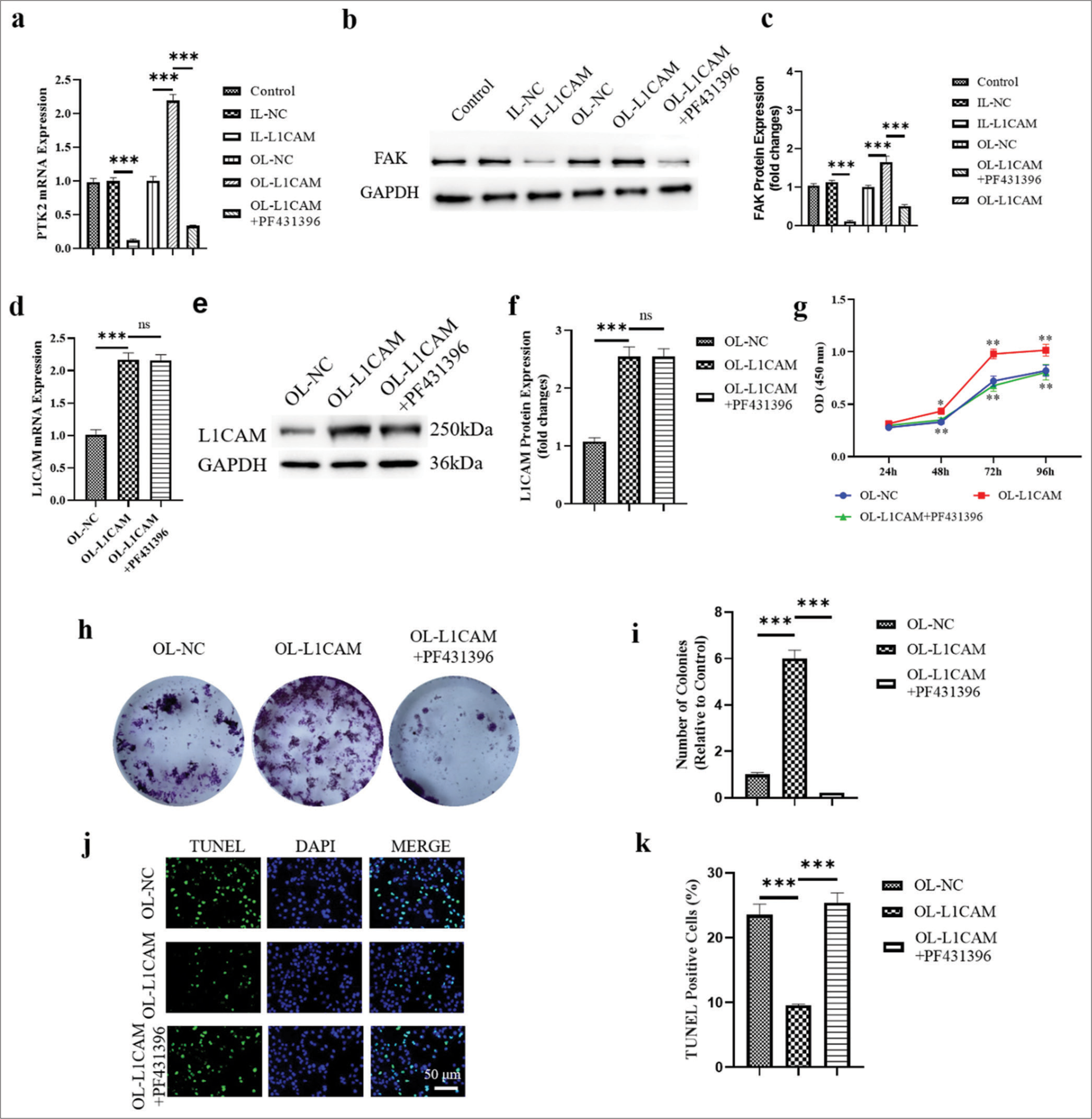 L1CAM promotes the proliferation and survival of EC cells by upregulating FAK. (a) The PTK2 mRNA levels obtained by RT-qPCR (n = 5). (b and c) The levels of FAK protein encoded by PTK2 obtained by Western blot (n = 5). The expression levels of (d) L1CAM mRNA (n = 5) and (e and f ) L1CAM protein (n = 5). Results of (g) CCK-8 assay (n = 5), (h and i) colony forming assay (n = 5), and (j and k) TUNEL assay (n = 5) for KLE cells. (** P < 0.01 indicates high statistical significance. *** P < 0.001 indicates very high statistical significance. ns stands for no significance. L1CAM: L1 cell adhesion molecule, EC: Endometrial cancer, mRNA: Messenger RNA, RT-qPCR: Reverse transcription quantitative real-time polymerase chain reaction, CCK: Cell counting kit, TUNEL: Terminal deoxynucleotidyl transferase-mediated dUTP nick-end labeling, FAK: Focal adhesion kinase, PKT2: Protein tyrosine kinase 2, NC: Negative control, OL: Overexpression lentivirus, L1CAM: L1 cell adhesion molecule, DAPI: 4’,6-Diamidino-2’-phenylindole.)