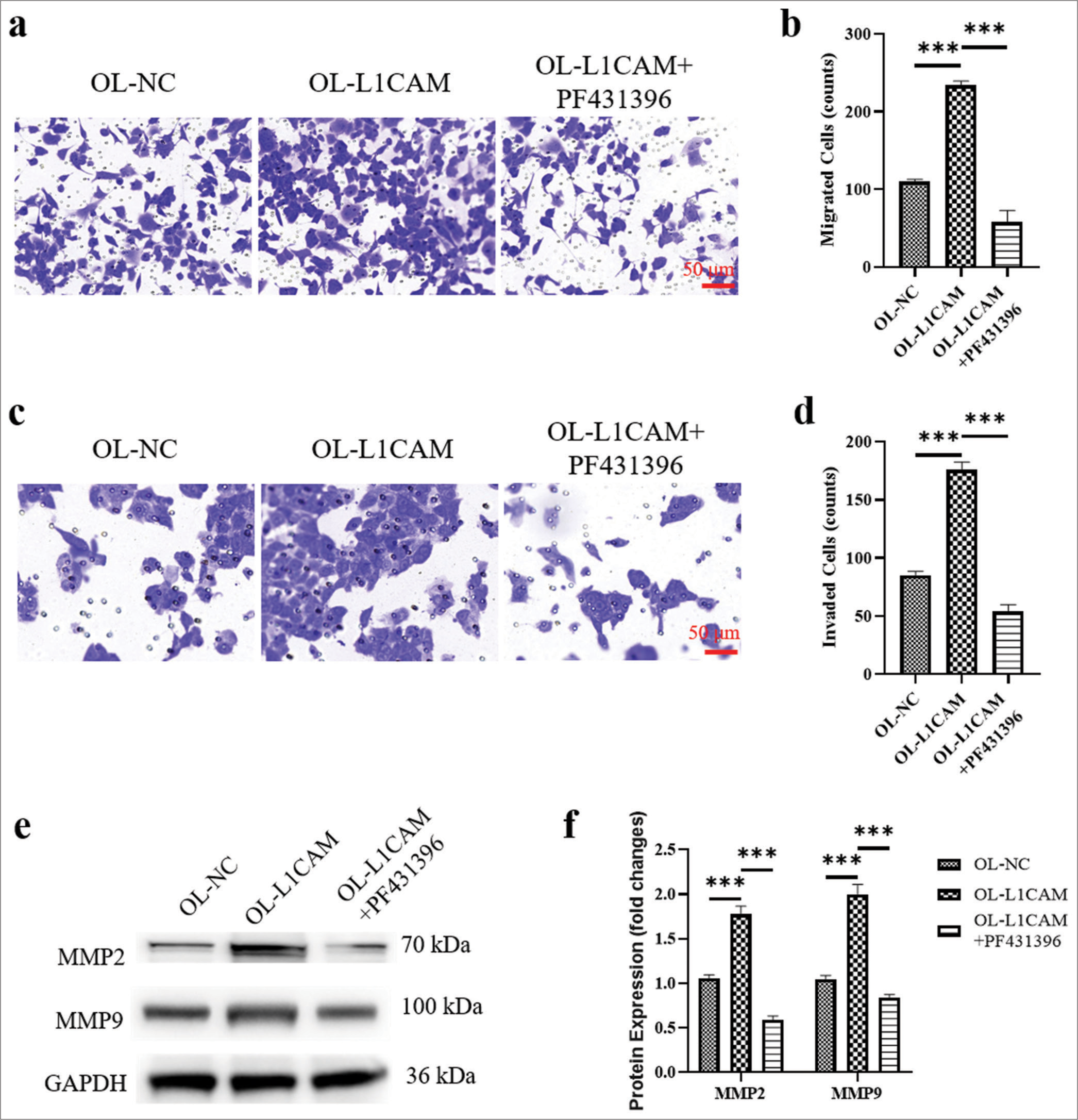 L1CAM promotes the metastasis of EC cells by upregulating FAK. (a and b) Transwell assay for migration (n = 5) and (c and d) transwell assay for invasion (n = 5) for KLE cells. (e and f) Protein levels of MMP2 and MMP9 obtained by Western blot (n = 5). ***P < 0.001 indicates very high statistical significance. L1CAM: L1 cell adhesion molecule, EC: Endometrial cancer, FAK: Focal adhesion kinase, MMP: Matrix metalloproteinase, NC: Negative control, LICAM: L1 cell adhesion molecule, OL: Overexpression lentivirus, MMP: Matrix metalloproteinase, GADPH: lyceraldehyde-3-phosphate dehydrogenase.)