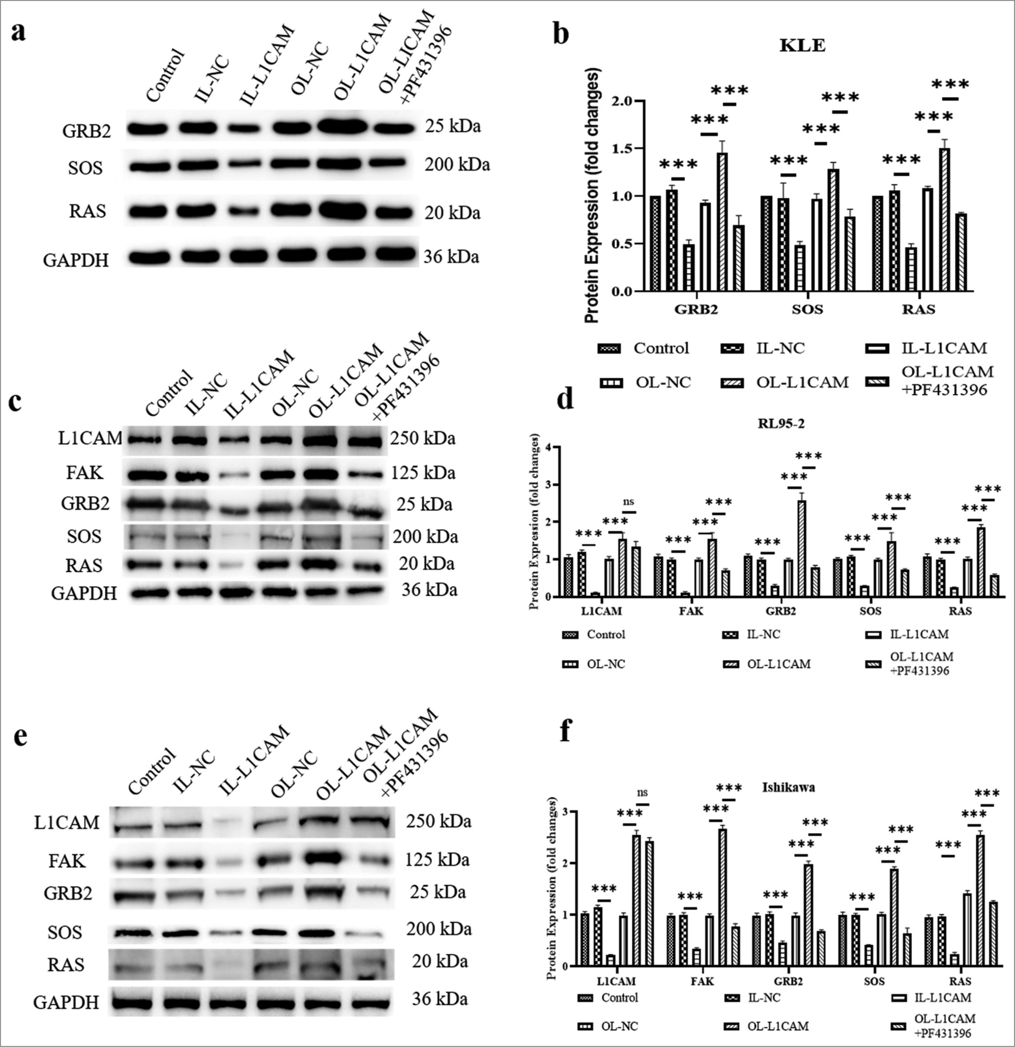 L1CAM functions by promoting the FAK–GRB2–SOS–RAS pathway. (a and b) Protein levels of GRB2, SOS and RAS in KLE cells (n = 5). Protein levels of L1CAM, FAK, GRB2, SOS, and RAS in (c and d) RL95-2 cells (n = 5) and (e and f) Ishikawa cells (n = 5). (***P < 0.001 indicates very high statistical significance. ns stands for no significance. L1CAM: L1 cell adhesion molecule, FAK: Focal adhesion kinase, GRB2: Growth factor receptor-bound protein 2, SOS: Son of sevenless, RAS: Rat sarcoma, NC: Negative control, GADPH: lyceraldehyde-3-phosphate dehydrogenase.)