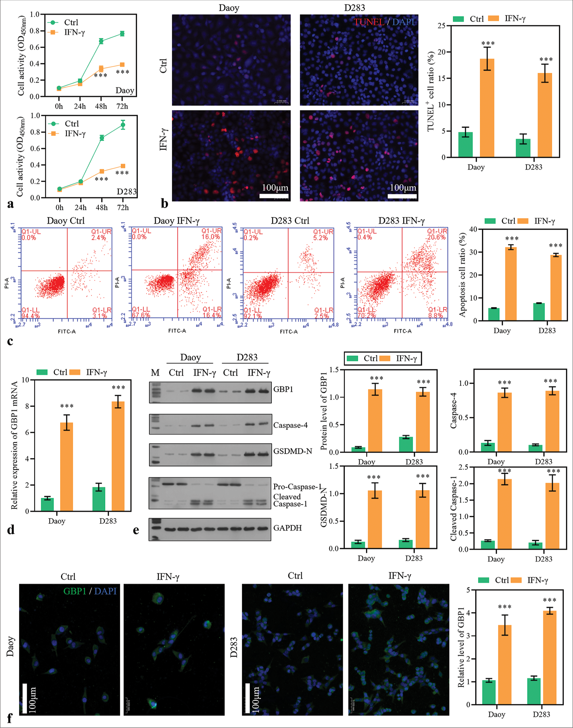 Stimulation with interferon-gamma (IFN-g) activated guanylate-binding protein (GBP)1 expression and pyroptosis. (a) Medulloblastoma (MB) cells were stimulated with IFN-g recombinant protein (100 ng/L), and cell activity was measured with cell counting kit-8. (b and c) The apoptosis of MB cells 48 h after virus infection was measured by TdT-mediated dUTP nick end labeling and flow cytometry assay. (d) GBP1 expression was detected using reverse transcription polymerase chain reaction. (e) The protein levels of GBP1, caspase-4, gasdermin D (GSDMD)-N, and caspase-1 were detected using Western blotting method. (f) The protein level of GBP1 detected using immunofluorescence assay. ***P < 0.001.