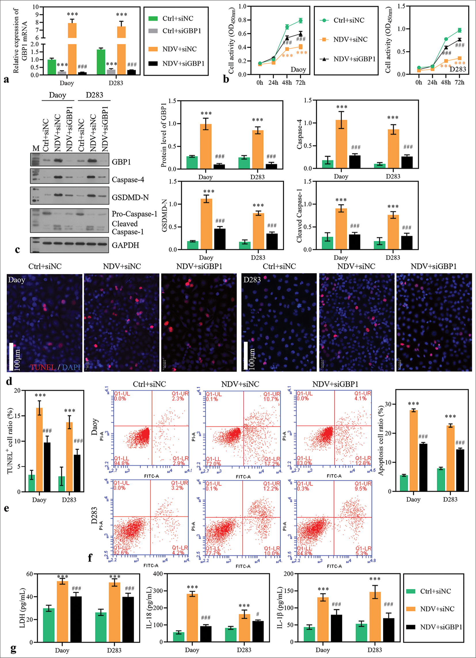 Guanylate-binding protein (GBP)1 knockdown alleviated Newcastle disease virus (NDV)-induced pyroptosis. Daoy and D283 cells were transfected with small interfering RNA targeting GBP1 and treated with NDV. (a) GBP1 expression was detected using reverse transcription polymerase chain reaction in medulloblastoma (MB) cells 48 h after treatment. (b) Cell activity was measured with cell counting kit-8. (c) The protein levels of GBP1, caspase-4, gasdermin D (GSDMD)-N, and caspase-1 were detected using Western blotting method. (d-f) The apoptosis of MB cells 48 h after treatment was measured using TdT-mediated dUTP nick end labeling and flow cytometry assay. (g) Lactate dehydrogenase, interleukin (IL)-18, and IL-1b levels in the supernatant. ***P < 0.001, versus Ctrl + siNC group; #P < 0.05, ###P < 0.001, versus NDV + siNC group.