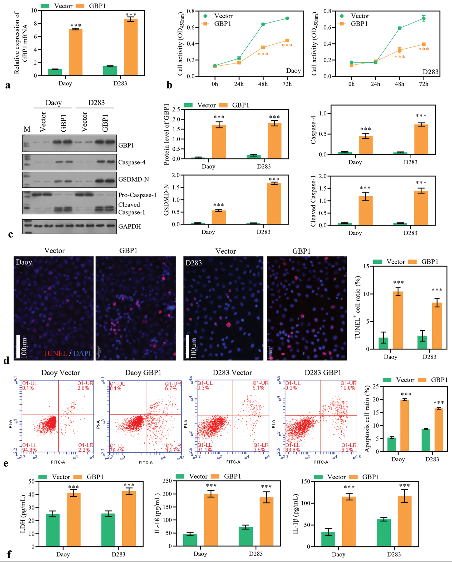 Guanylate-binding protein (GBP)1 overexpression promotes medulloblastoma (MB) cell pyroptosis. (a) GBP1 expression was detected using reverse transcription polymerase chain reaction in MB cells 48 h after transfection. (b) Cell activity was measured with cell counting kit-8. (c) The protein level of GBP1, caspase-4, GSDMD-N, and caspase-1 was detected using Western blotting method. (d and e) The apoptosis of MB cells 48 h after transfection was measured using TdT-mediated dUTP nick end labeling and flow cytometry assay. (f) Lactate dehydrogenase, interleukin (IL)-18, and IL-1b levels in the supernatant. ***P < 0.001.