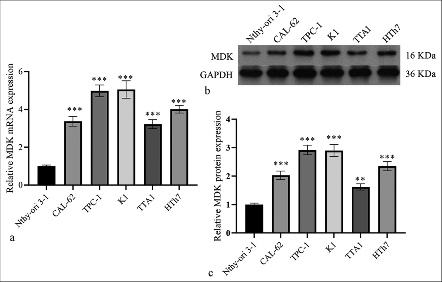 MDK messenger RNA and protein expression levels were dramatically elevated in TC cells. (a-c) MDK mRNA (a) and protein (b and c) in Nthy-ori3-1 cells and five TC cell lines were evaluated by qRT-PCR and Western blotting, respectively. (**P < 0.01 and ***P < 0.001 compared with Nthy-ori3-1 cells). n = 3. (MDK: Midkine, TC: Thyroid cancer, qRT-PCR: Quantitative real-time polymerase chain reaction.).