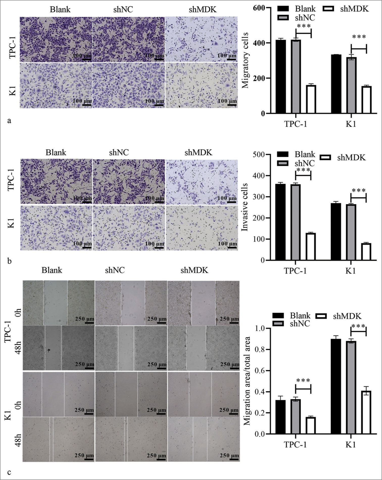 MDK knockdown suppressed TC cell metastasis. (a and b) The migratory (a) and invasive (b) cells after transformation with shMDK or shNC were assessed using Transwell assays. (c) The migration of TPC-1 and K1 cells after transformation with shMDK or shNC was assessed using wound-healing assays (***P < 0.001). n = 3. (MDK: Midkine, shNC: Negative control of short hairpin RNA, shMDK: Short hairpin RNA of MDK, TC: Thyroid cancer.).