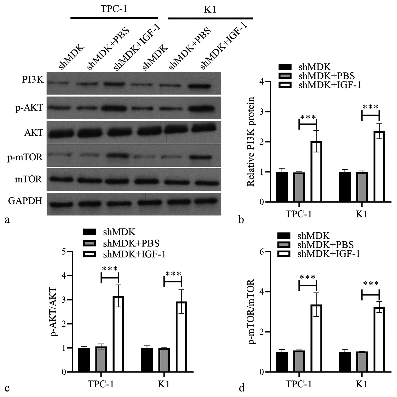 Activating PAmT-P elevated PAmT-P-related protein in TPC-1 and K1 cells transformed with shMDK. (a) The protein levels of PI3K, PI3K, p-AKT/AKT, and p-mTOR/mTOR were measured using Western blotting. (b-d) Histogram represents the PI3K protein level, p-AKT/AKT, and p-mTOR/mTOR after IGF-1 treatment (***P < 0.001). n = 3. (MDK: Midkine, shMDK: Short hairpin RNA of MDK, PI3K: Phosphatidylinositol 3 kinase, AKT: Protein kinase B, mTOR: Mammalian target of rapamycin, p-AKT: Phosphorylated AKT, p-mTOR: Phosphorylated mTOR, PBS: Phosphate buffer saline, IGF-1: Insulin-like growth factor 1, PAmT-P: PI3K/Akt/mammalian target of rapamycin pathway.).