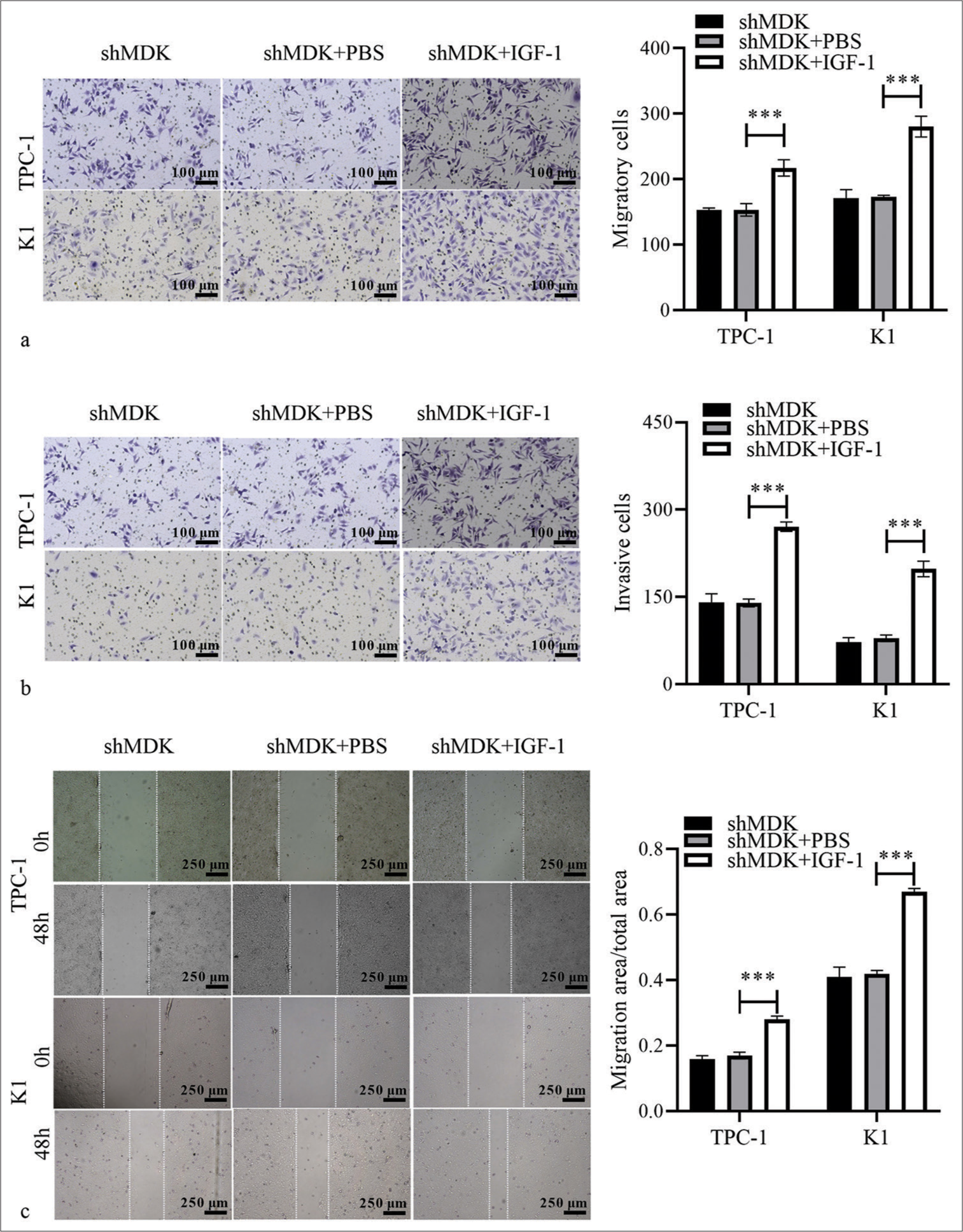 Activation of PAmT-P can reverse the repressive effect of MDK knockdown on TC cells. (a and b) The migratory and invasive abilities of MDK-knockdown TPC-1 and K1 cells after IGF-1 treatment were evaluated using Transwell assays. (c) The migratory abilities of MDK knockdown TPC-1 or K1 cells after IGF-1 treatment were analyzed using wound-healing assays. (***P < 0.001). n = 3. (MDK: Midkine, shMDK: Short hairpin RNA of MDK, PBS: Phosphate buffer saline, IGF-1: Insulin-like growth factor 1, TC: Thyroid cancer, PAmT-P: PI3K/Akt/mammalian target of rapamycin pathway.)