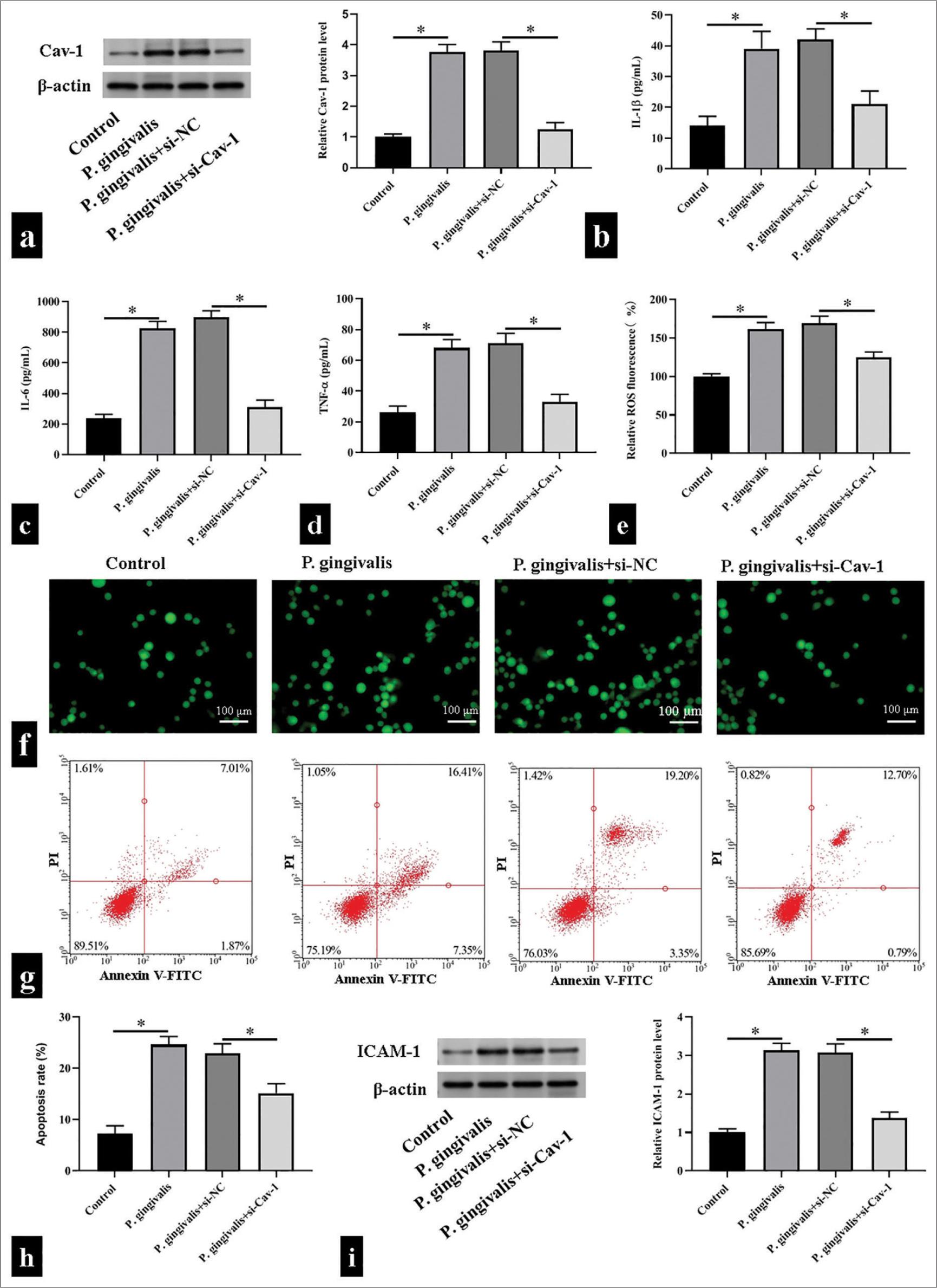 Caveolin 1 (Cav-1) triggered Porphyromonas gingivalis (P. gingivalis)-induced oxidative stress, inflammatory responses, and cell apoptosis of human umbilical vein endothelial cells. (a) Cav-1 protein levels detected using Western blotting. (b-f) Interleukin (IL)-1β, IL-6, tumor necrosis factor-α, and reactive oxygen species levels detected using enzyme-linked immunosorbent assay kits and 2',7'-dichlorodihydrofluorescein diacetate fluorescence probe, respectively, scale bar = 100 μm (n = 5). (g and h) Detected cell apoptosis levels using flow cytometry (n = 3). (i) Detected intercellular cell adhesion molecule-1 (ICAM-1) protein levels using Western blotting. (n = 3). si-NC: small interfering RNA negative control, si-Cav-1: small interfering RNA Caveolin 1, V-FITC: V-Fluorescein Isothiocyanate.*P < 0.05.