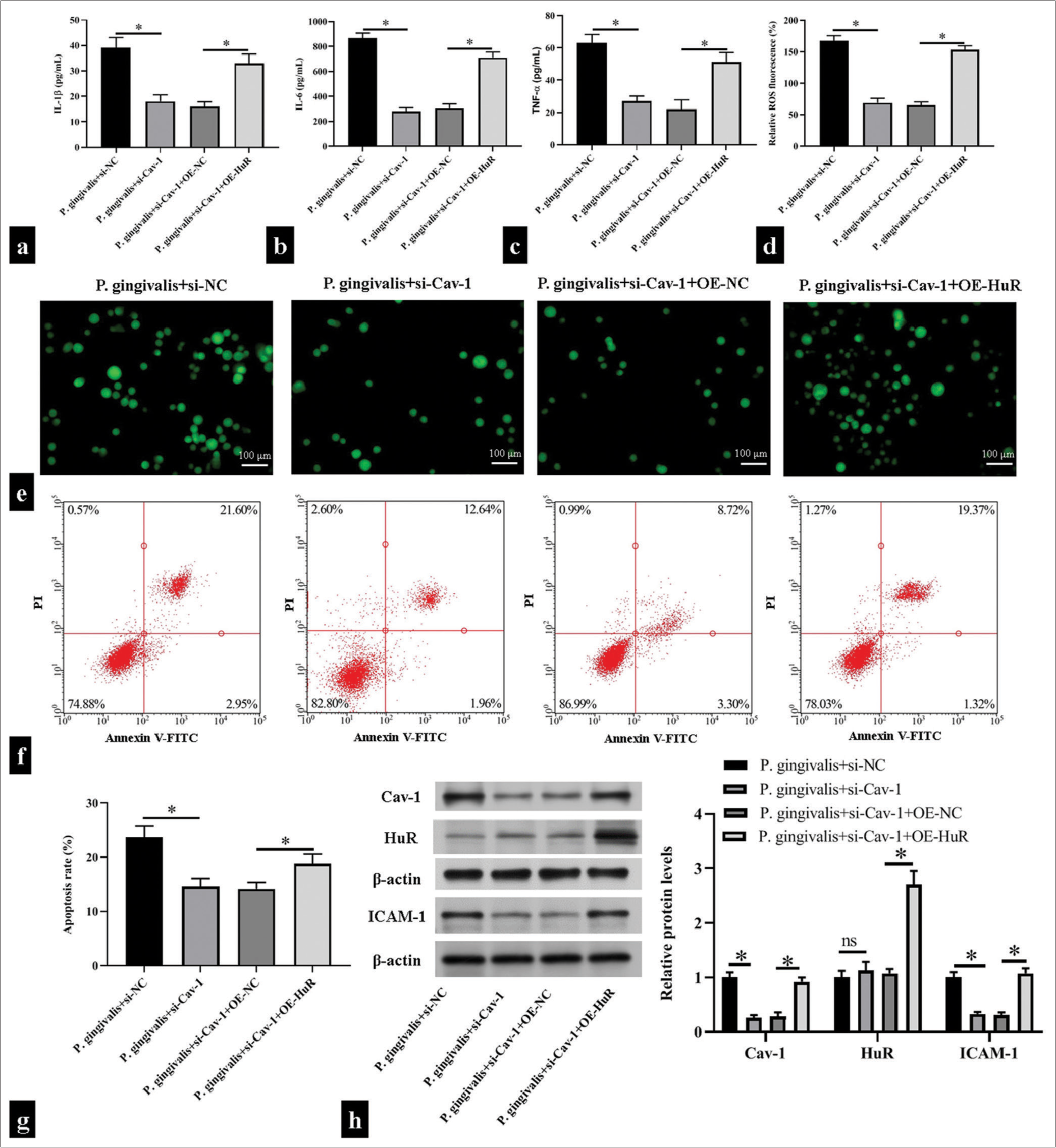 Caveolin 1 (Cav-1) triggered Porphyromonas gingivalis (P. gingivalis)-induced inflammatory responses, oxidative stress, and cell apoptosis of human umbilical vein endothelial cells (HUVECs) by binding to human antigen R (HuR). HUVECs were transfected with small interfering ribonucleic acid HuR (si-HuR) alone or together with overexpression HuR (OE-HuR) plasmid and then subjected to P. gingivalis. (a-e) Enzyme-linked immunosorbent assay kits and 2',7'-dichlorodihydrofluorescein diacetate fluorescence probe were used in measuring the levels of interleukin (IL)-1β, IL-6, tumor necrosis factor-α, and reactive oxygen species in the supernatant of the HUVECs; Scale bar = 100 μm; (n = 5). (f and g) Flow cytometry was used in detecting changes in apoptosis level in the HUVECs (n = 5). (h) Changes in Cav-1, HuR, and intercellular cell adhesion molecule-1 (ICAM-1) levels were detected through Western blotting (n = 3). si-NC: small interfering RNA negative control, OE-NC: Overexpression plasmid negiative control, V-FITC: V-Fluorescein Isothiocyanate. *P < 0.05.