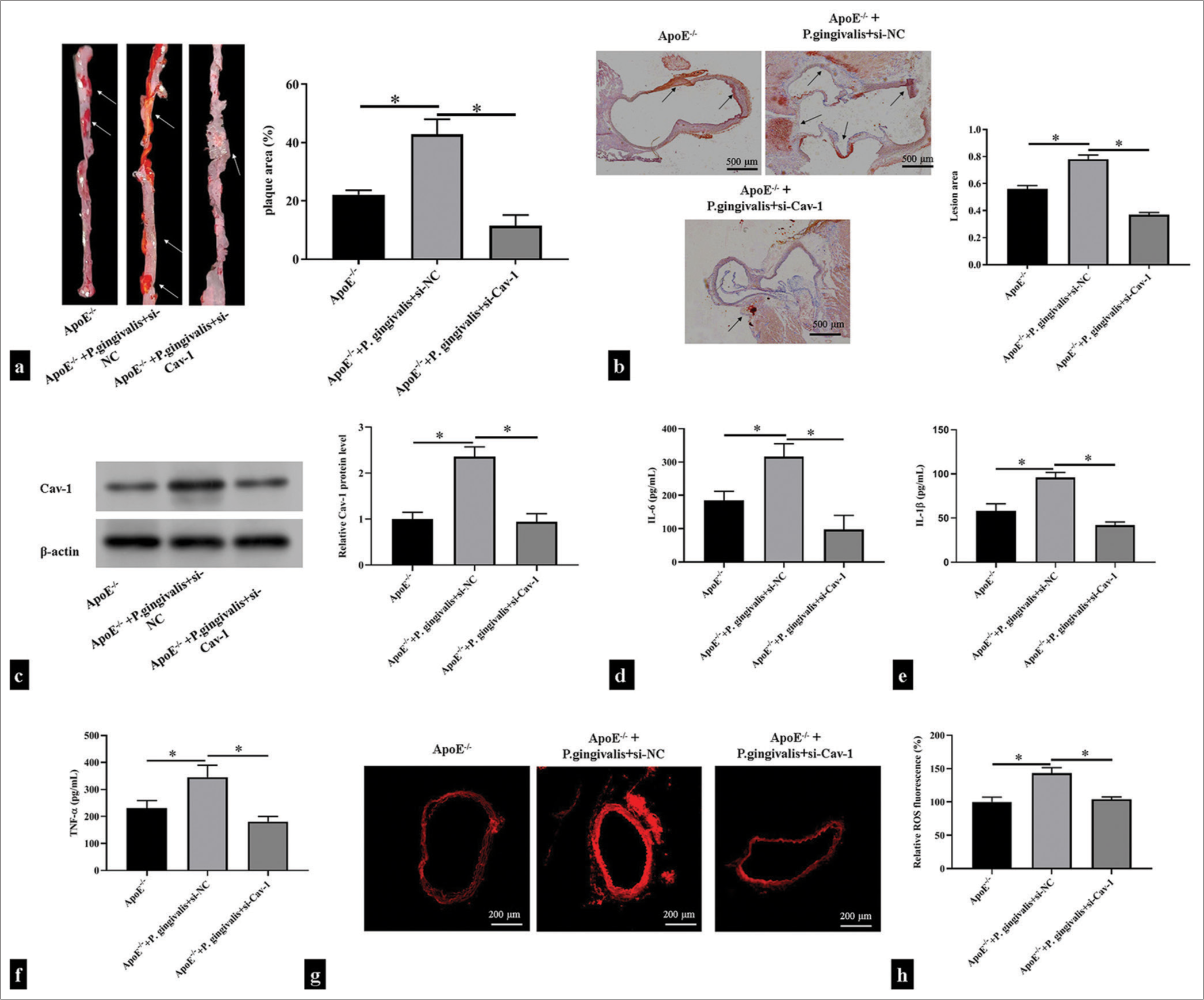 Caveolin 1 (Cav-1) was involved in Porphyromonas gingivalis-induced atherosclerotic plaque formation. ApoE−/− mice were injected with si-Cav-1 and then infected with P. gingivalis. (a) Oil Red O-stained thoracoabdominal aortas of the ApoE−/− mice (n = 5). The white arrow showed areas of atherosclerotic lesions on the surface of the aorta. (b) Oil Red O-stained mouse aortic roots of the ApoE−/− mice (n = 5). Scale bar = 500 μm. Magnification is 20x. The black arrow shows areas of atherosclerotic lesions in the aortic root. (c) Western blotting detection of Cav-1 in mouse aortic tissues (n = 5). (d-h) Enzyme-linked immunosorbent assay and dihydroethidium fluorescence probe detection of the levels of proinflammatory cytokines and reactive oxygen species in the supernatant of the mouse aortic tissues (n = 5). Scale bar = 200 μm. Magnification is 50x. *P < 0.05.